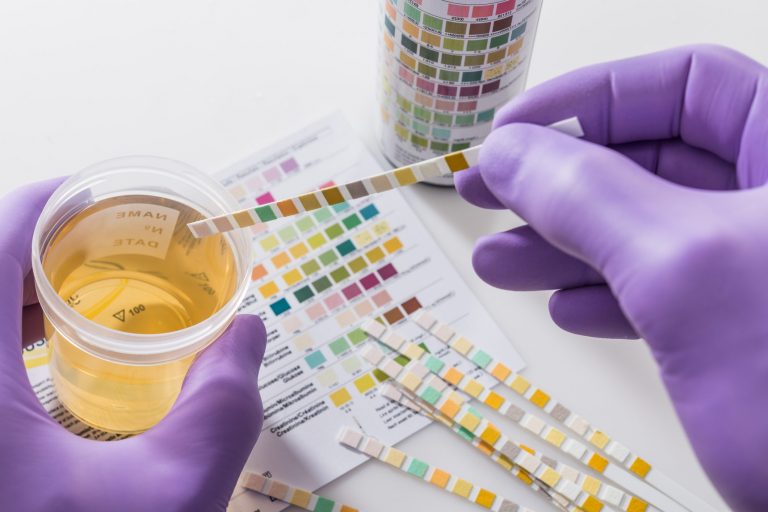 Leucociti nelle urine (leucocituria) le cause e quando preoccuparsi Ohga! Leucociti nelle urine (leucocituria) le cause e quando preoccuparsi Ohga!