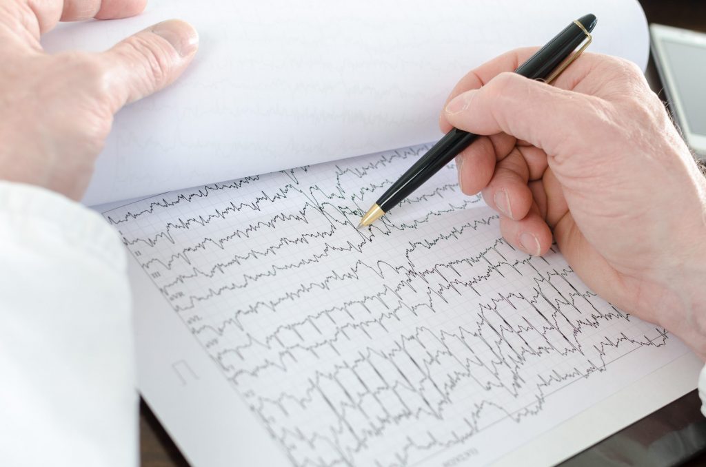 A Cosa Serve Il Defibrillatore Sottocutaneo