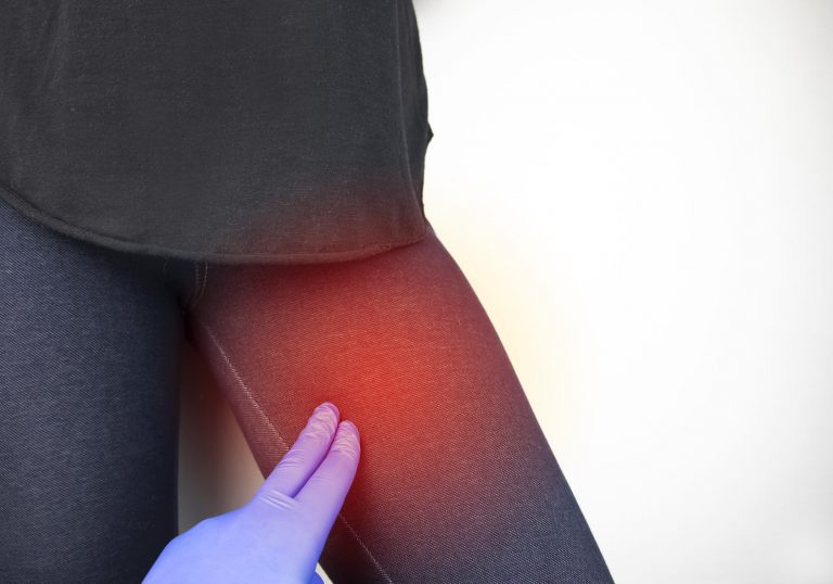 Stiramento Muscolare Sintomi Cause E Cura Ohga 
